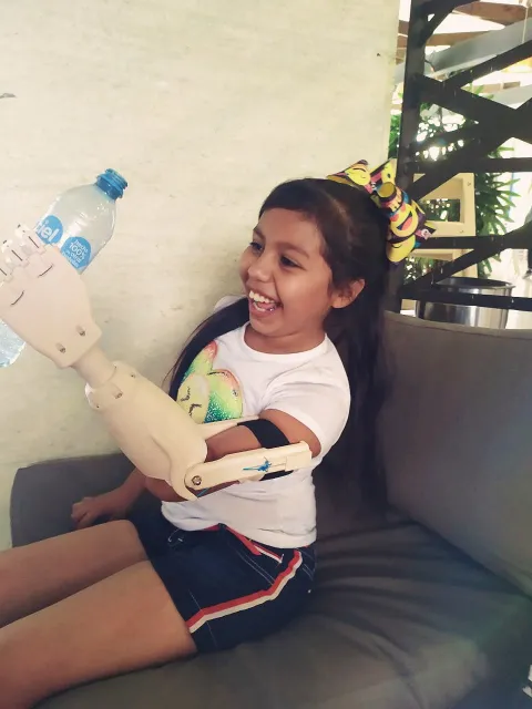 Girls holds plastic water bottle with prosthetic arm